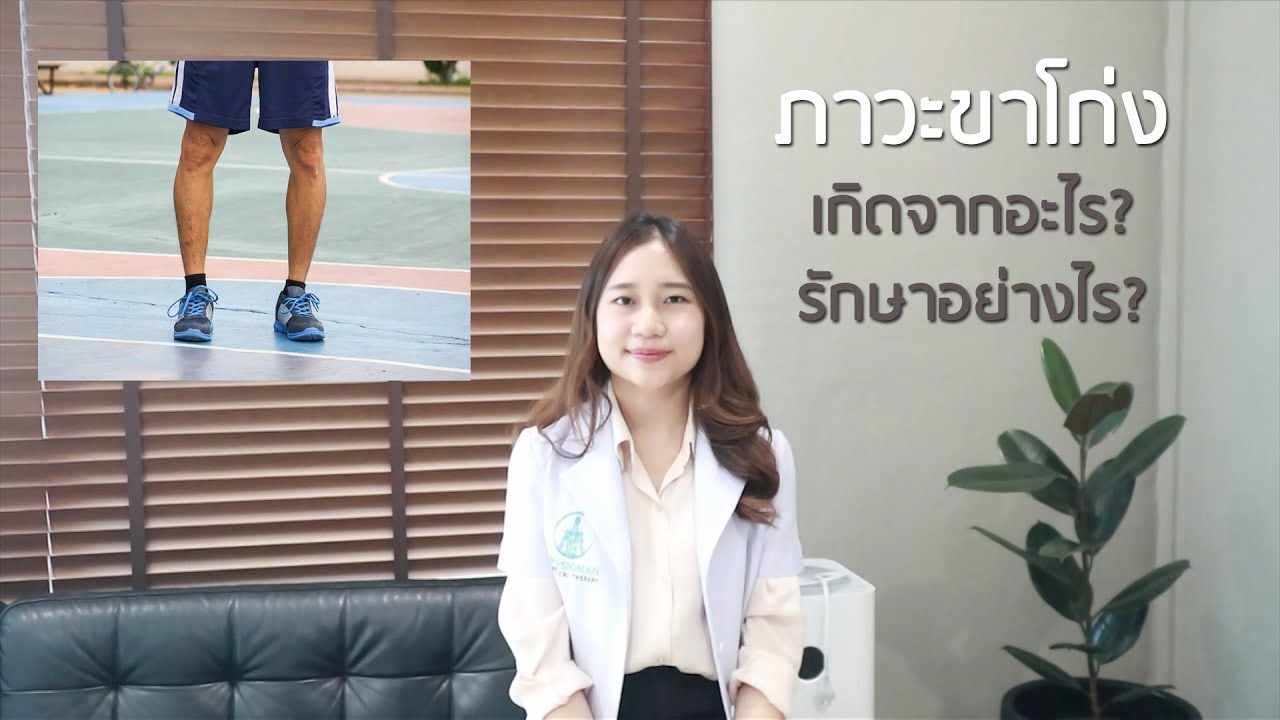 ภาวะขาโก่ง EP.1 : รู้จักกับภาวะขาโก่ง และวิธีตรวจเช็คตนเองว่าเป็นหรือไม่