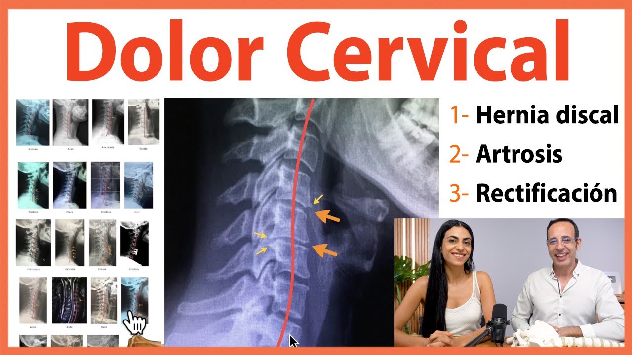 🔴 Dolor Cervical | HERNIA DISCAL, RECTIFICACIÓN y ARTROSIS 👉 Causas ocultas para el Yoga y Pilates