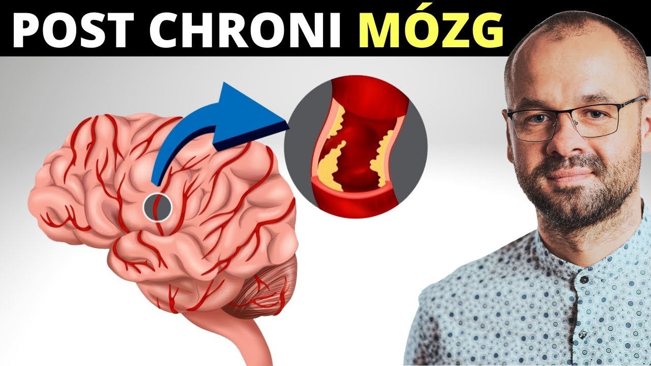 Post regeneruje MÓZG i chroni przed udarem. Który dokładnie?