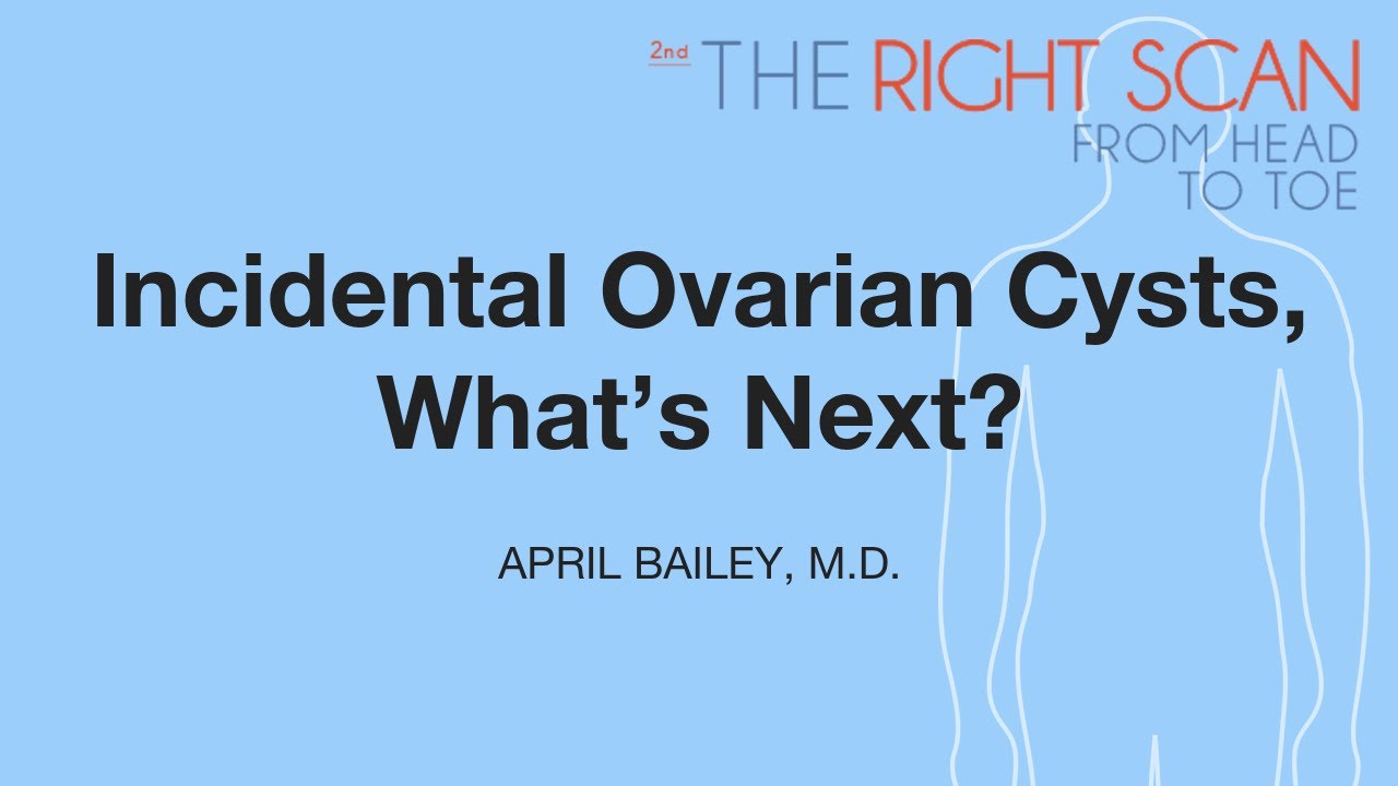 Incidental Ovarian Cysts, What's Next?