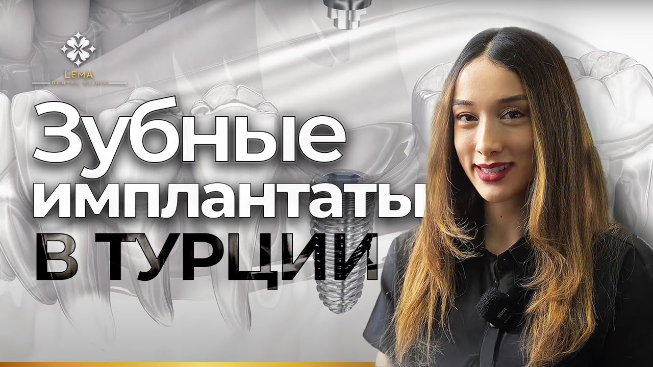 🤍 (с субтитрами) Сколько дней занимает установка зубного имплантата? Стоматологическая клиника Лема