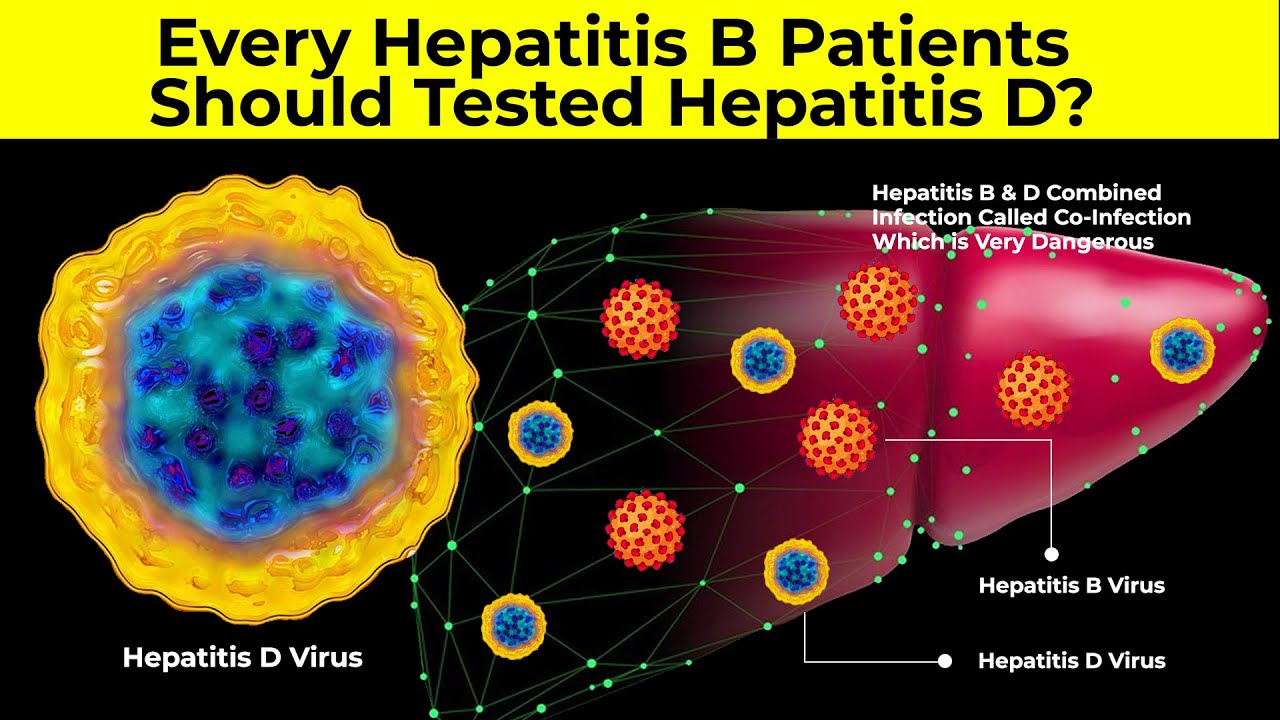 Hepatitis B Patients Should Tested Hepatitis D? | Hepatitis D | Delta Virus