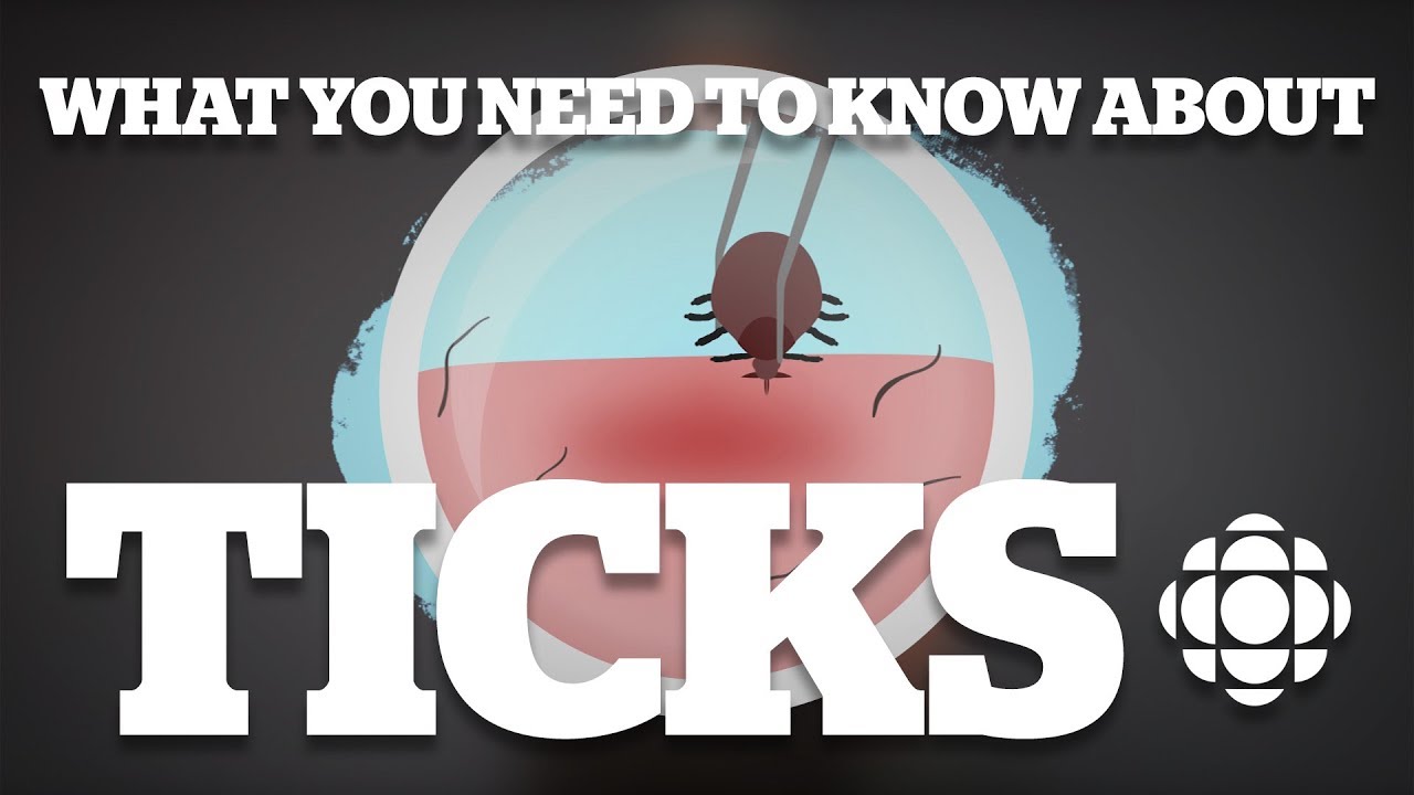 What you need to know about ticks
