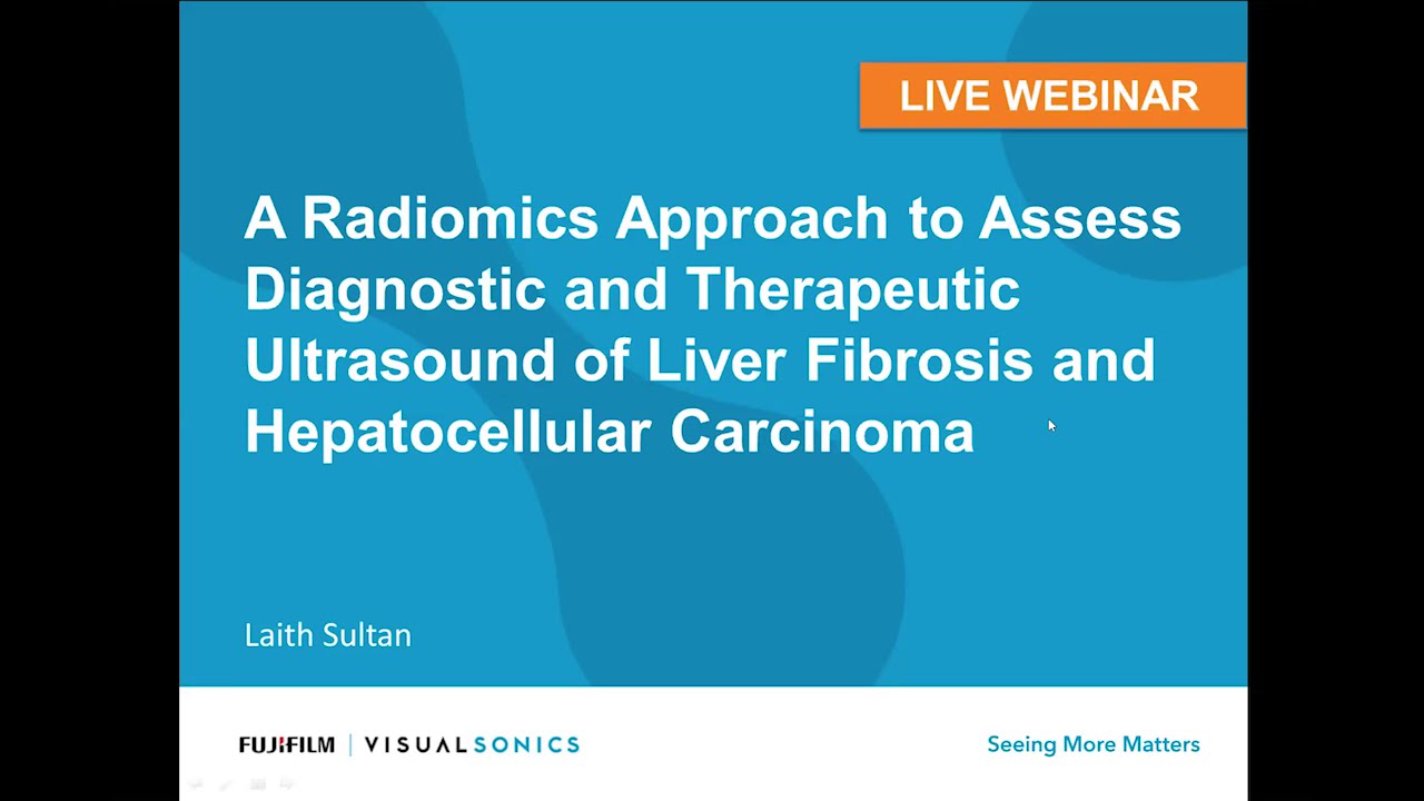 December 2018: Ultrasound of Liver Fibrosis & Hepatocellular Carcinoma