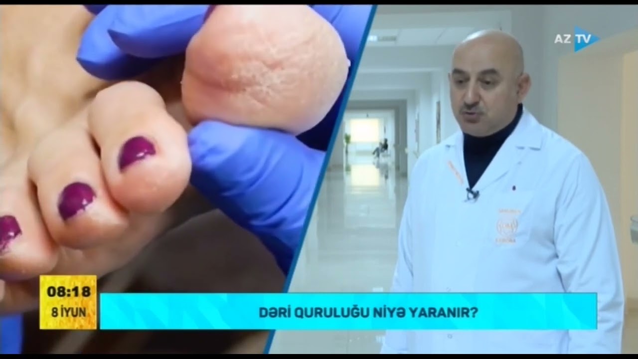 Dəri quruluğu nədən yaranır?