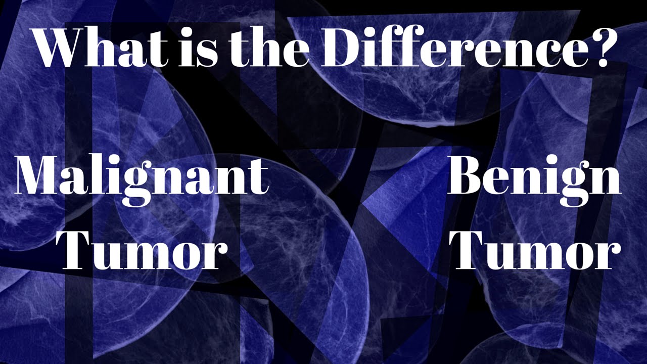 What Is the Difference between a Benign and Malignant Tumor?