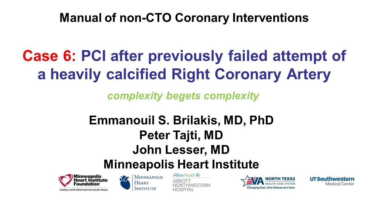 Case 6: PCI Manual - Severe calcification and distal vessel perforation