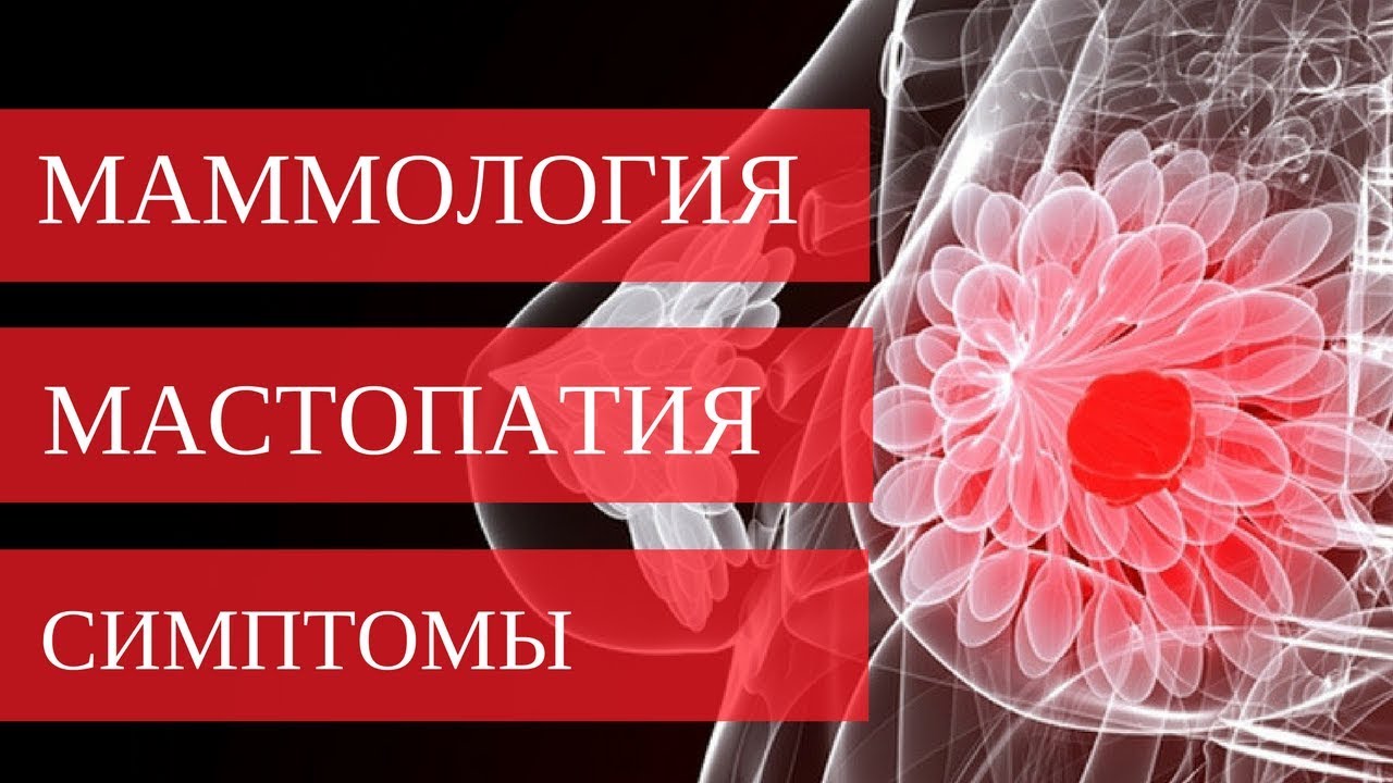 Как распознать МАСТОПАТИЮ молочной железы? Ответ в видео!