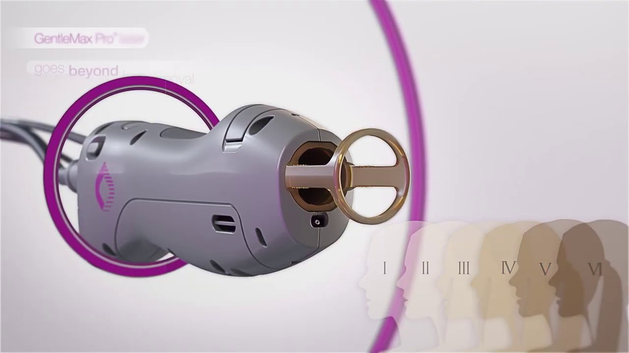 Candela GentleMax Pro - Alexandrite + Nd:Yag