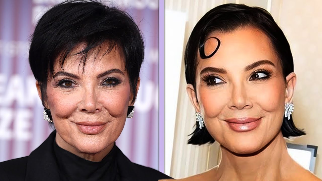 Kris Jenner's Plastic Surgeon REVEALED as Star Sports Fresh Look