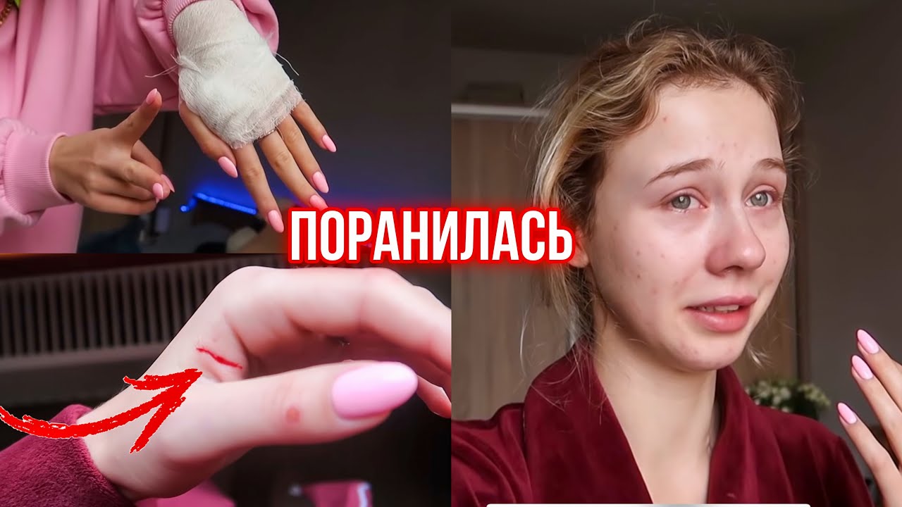 Поранила руку жестяной банкой 😭 Что за чёрная полоса? Боюсь зашивать 🥺