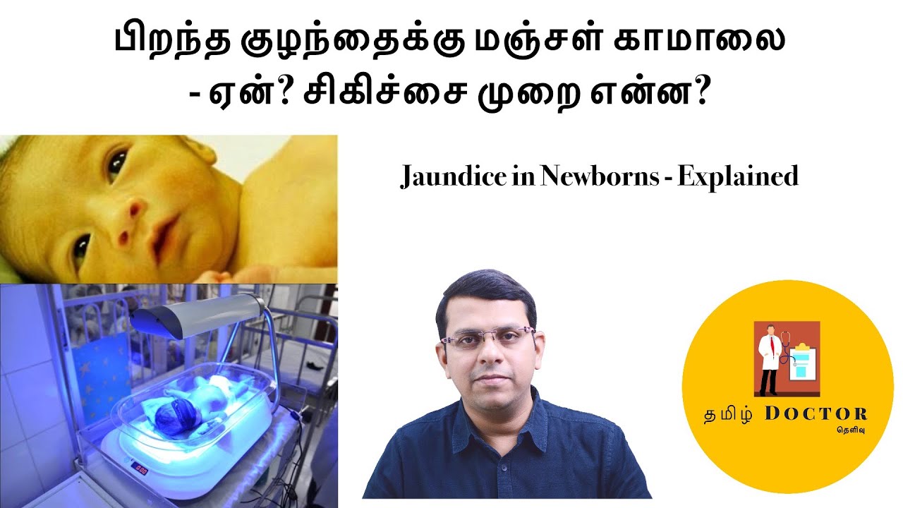 பிறந்த குழந்தைக்கு மஞ்சள் காமாலை | ஏன்? சிகிச்சை முறை என்ன?| Jaundice in Newborns - Explained| தமிழ்