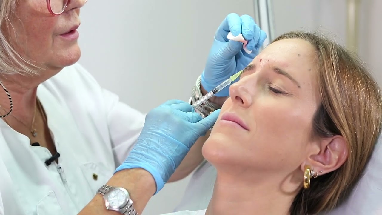 Prevención de arrugas de expresión en el  tercio superior de la cara. Los Médicos también se tratan