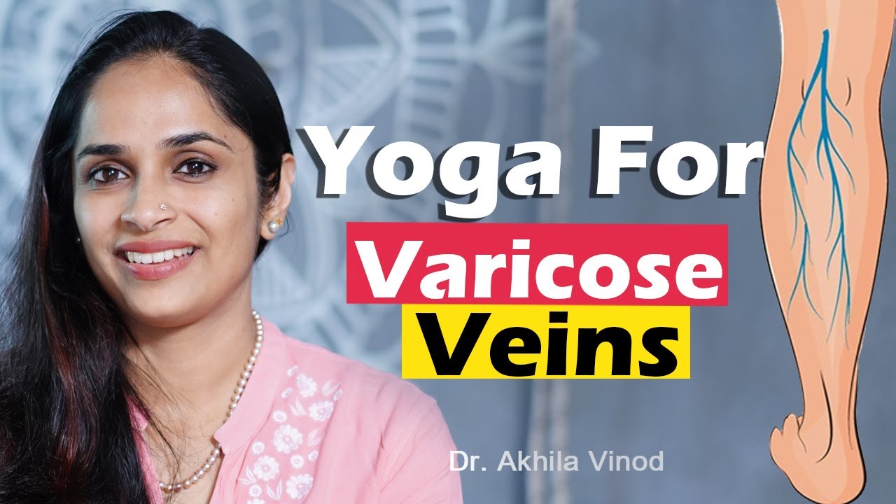 വെരികോസ് വൈൻ മാറാൻ ഫലപ്രദമായ യോഗ | yoga for varicose veins