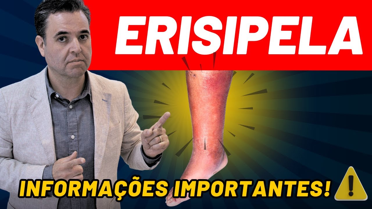 Erisipela: como identificar, tratar e evitar que volte (médico explica tudo)