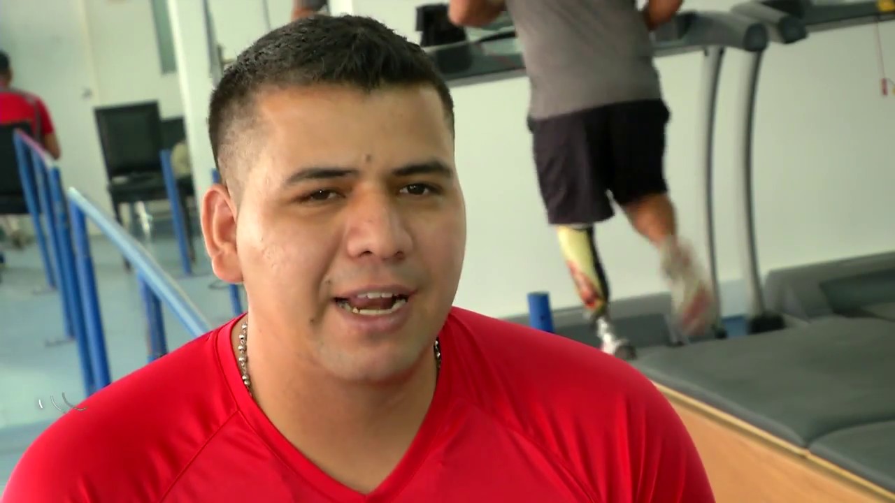 LAS  PROTESIS DEL HOSPITAL MILITAR