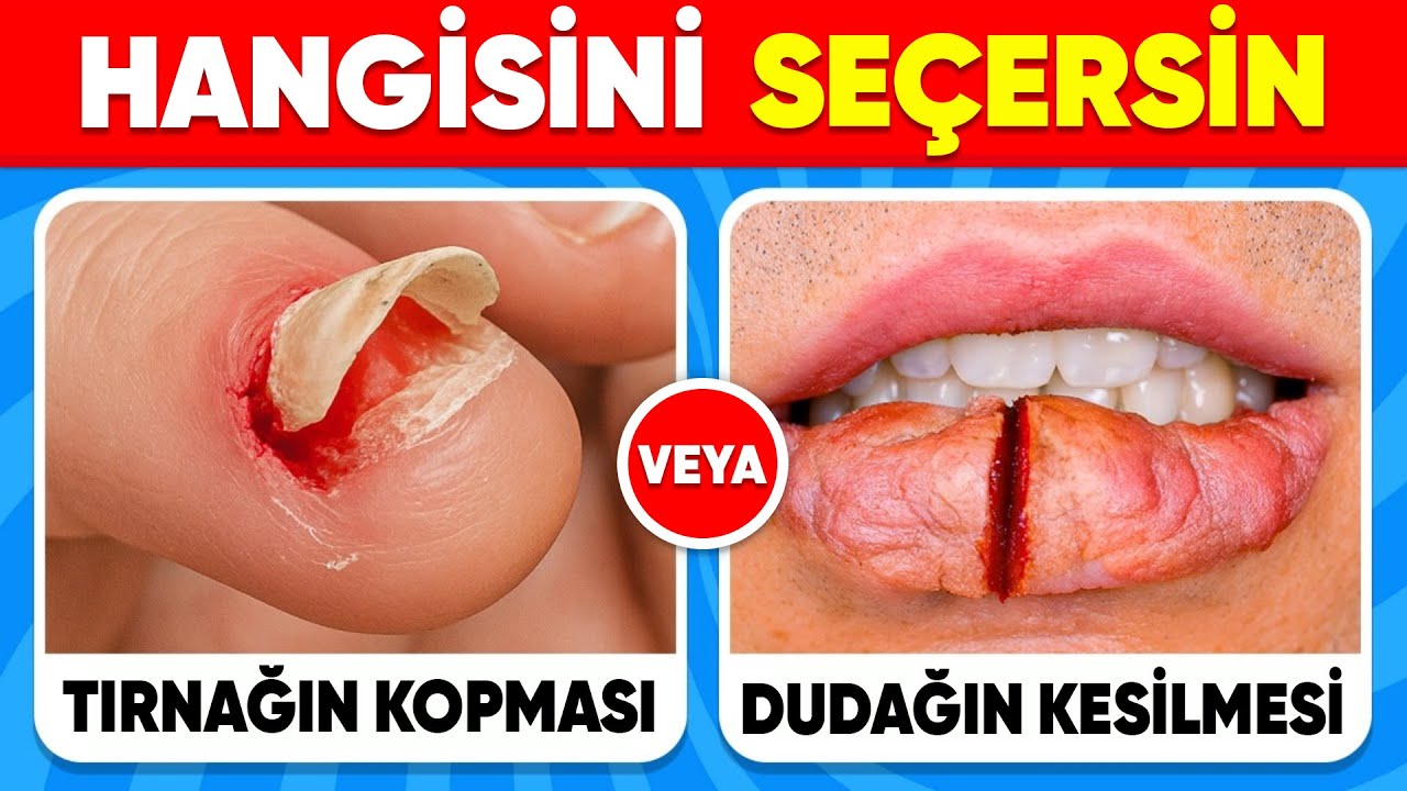 Hangisini Tercih Edersin...? En Zor Se&ccedil;imler! 😱⚠️❓ | En Zor Kararlar