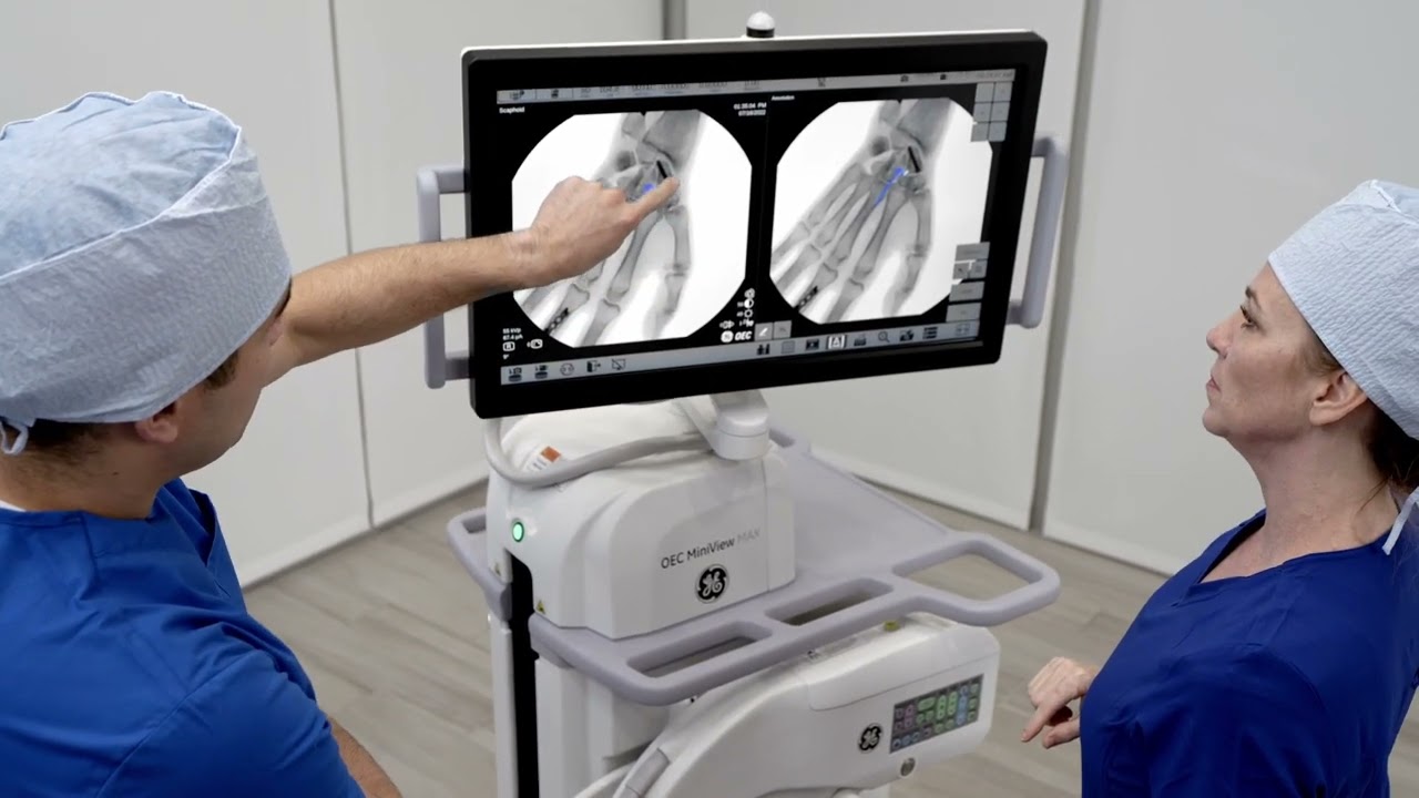 OEC MiniView MAX Product Video