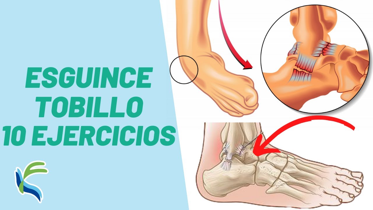 10 EJERCICIOS para CURAR el ESGUINCE de TOBILLO Fisioterapia | Fisiolution