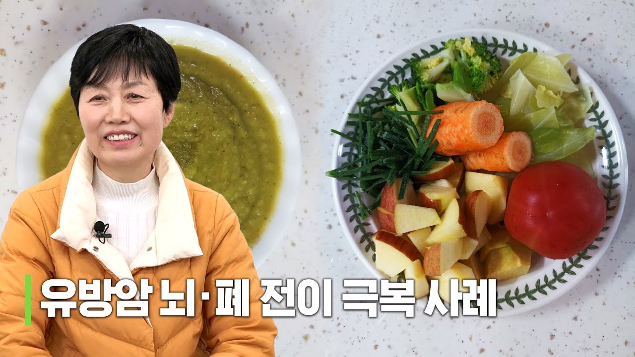 유방암 뇌,폐 전이 극복 사례