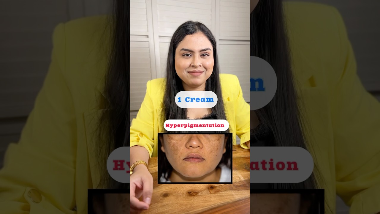 One Cream under Rs 200 that treats hyperpigmentation acne marks pimples treatment at home clear skin