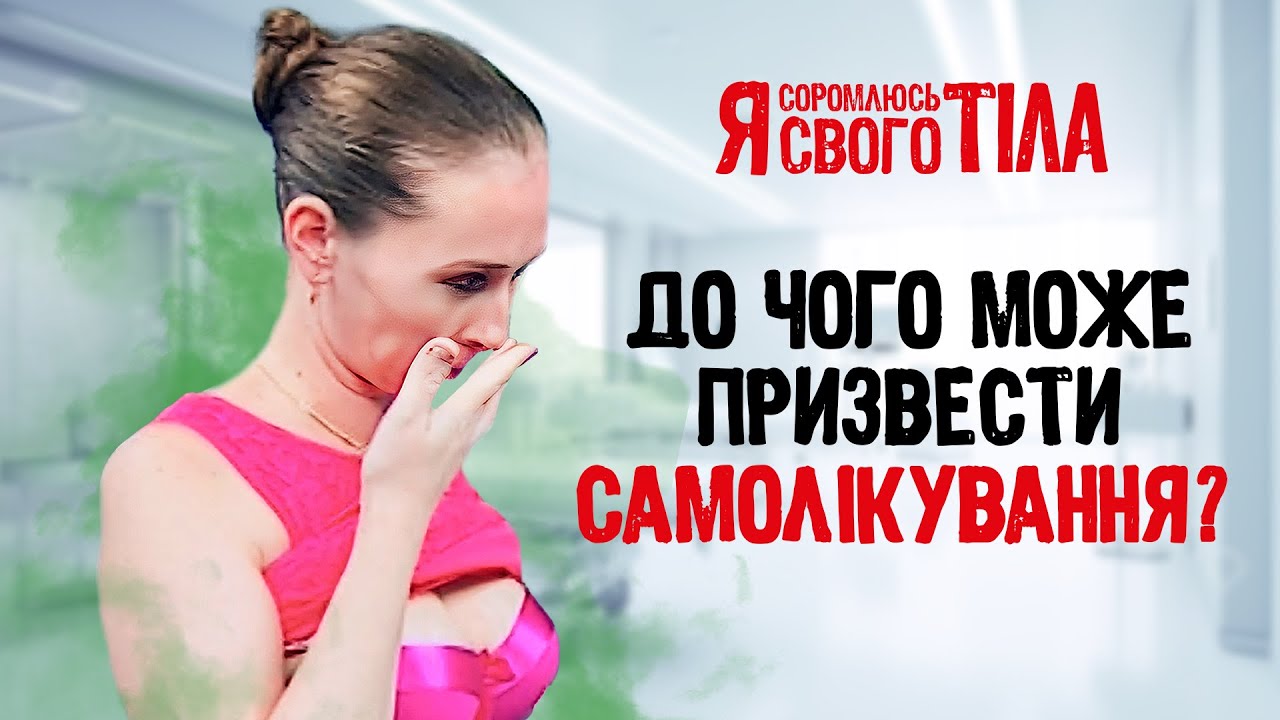 Женщина лечила опухоль березовым грибом – Я соромлюсь свого тіла | МЕДИЦИНА | ВРАЧИ