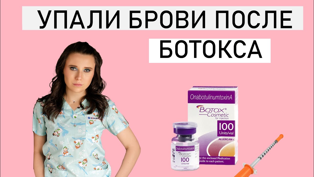 УПАЛИ БРОВИ ПОСЛЕ БОТОКСА.