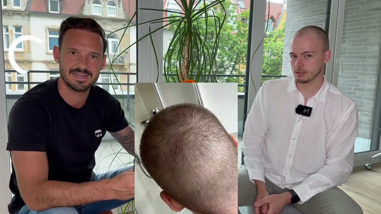 Vor- und Nachteile von einem Haarteil / Haarsystem Teil 2