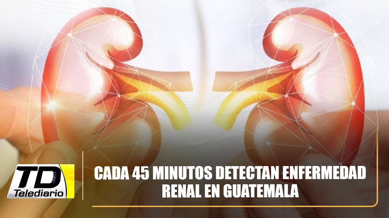 Cada 45 minutos detectan enfermedad renal en Guatemala