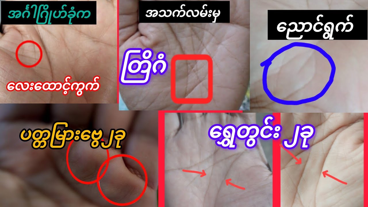 ညောင်ရွက်ပါရင် ခံစားရမည့်ကောင်းကျိုး(၇)ချက်နှင့် ရွှေတွင်းများ....