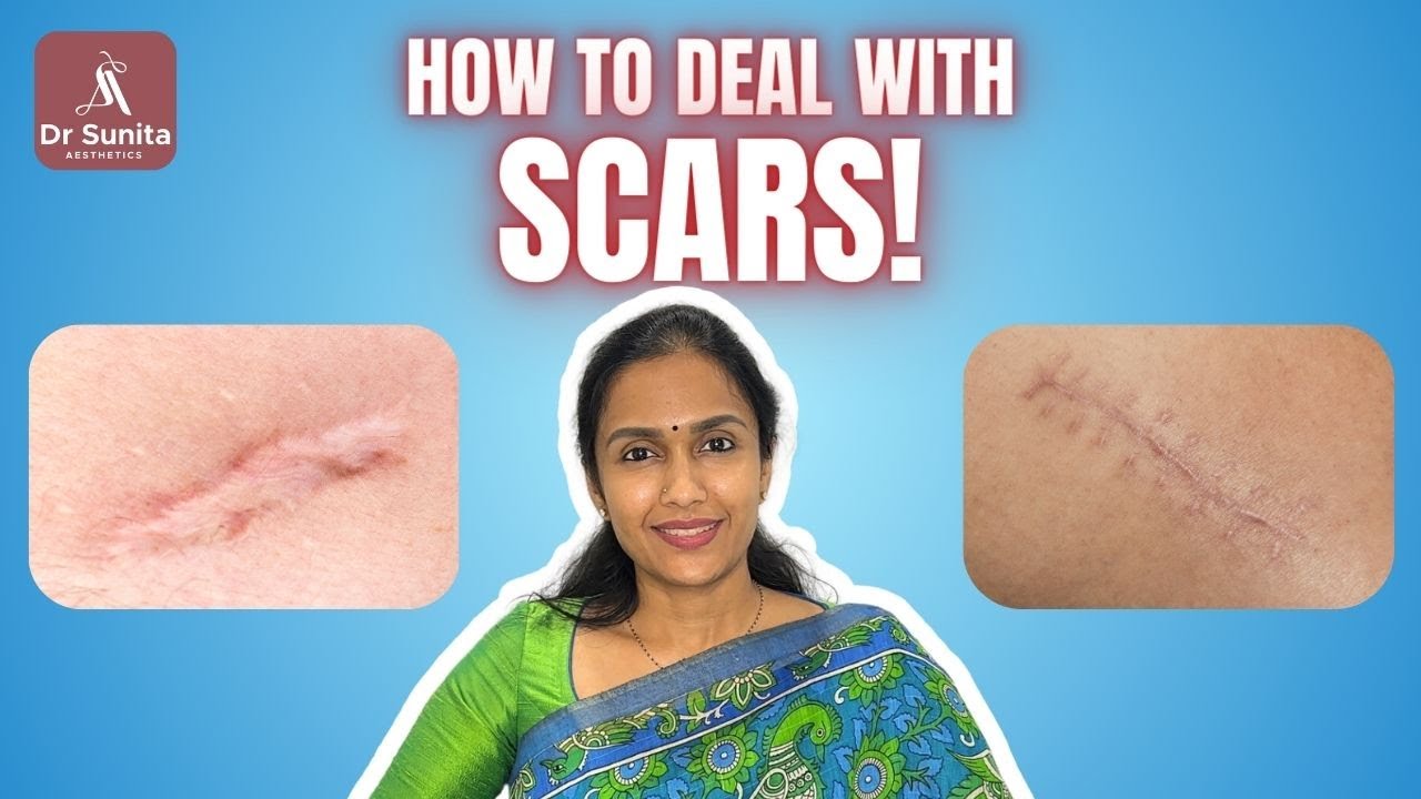 Scar Revision Treatment | Dr. Sunita Aesthetics | Top Plastic Surgeon in Vizag