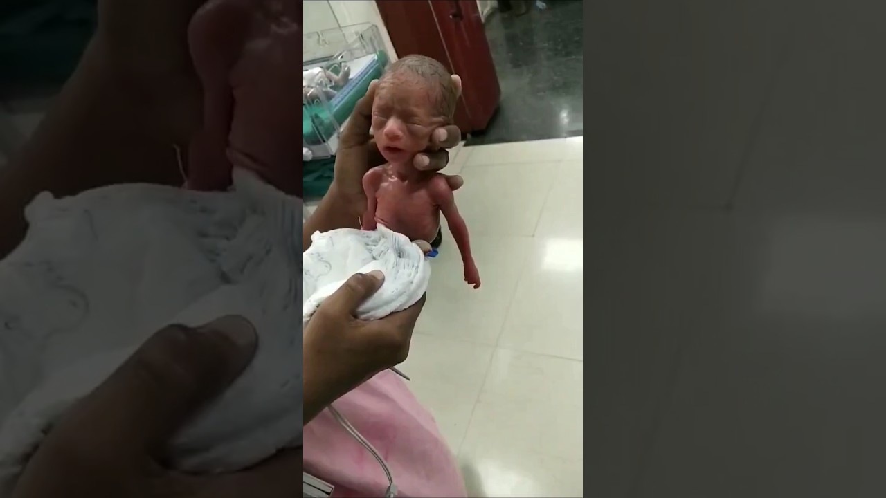 baby of five months  ##weight 400grams ## male baby #soo cute small baby##baby is serious plz help 🙏