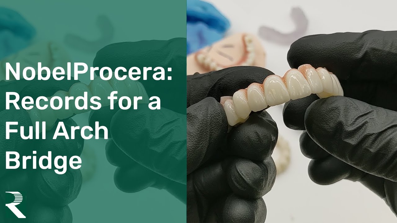 NobelProcera&reg;: Records Required for a Full Arch Bridge