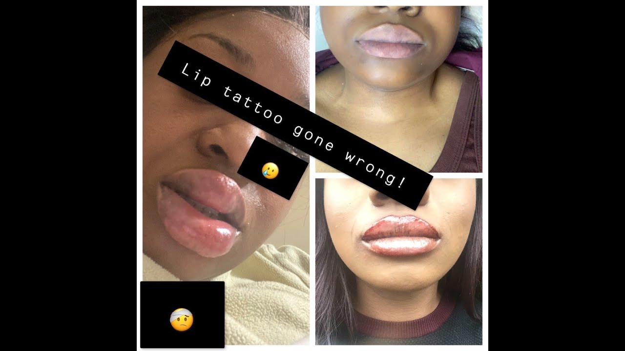 LIP TATTOO GONE HORRIBLY WRONG! WHAT NOT TO DO + LASER HAIR REMOVAL UPDATE | ZOES WAY
