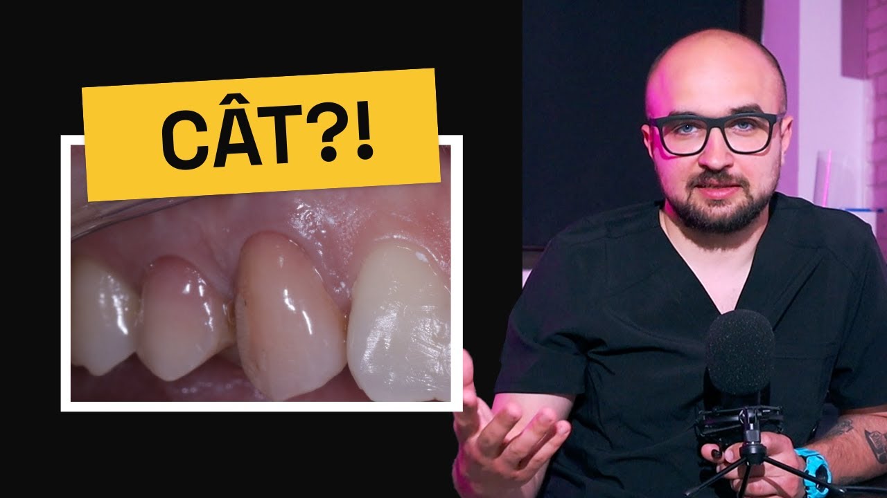 CAT COSTA DOUA COROANE DIN CERAMICA?