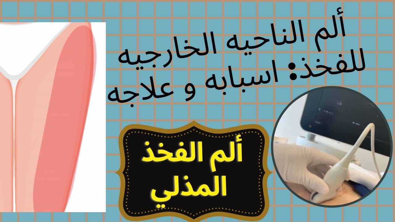 ألم الناحيه الخارجيه للفخذ: اسبابه و علاجه  :ألم الفخذ المذلي