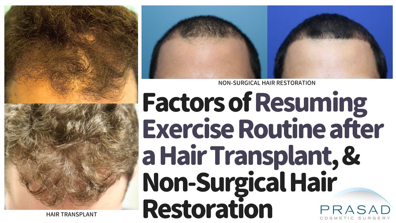 Factors in Resuming Exercise after a Hair Transplant, and Faster Return from Non-Surgical Treatment