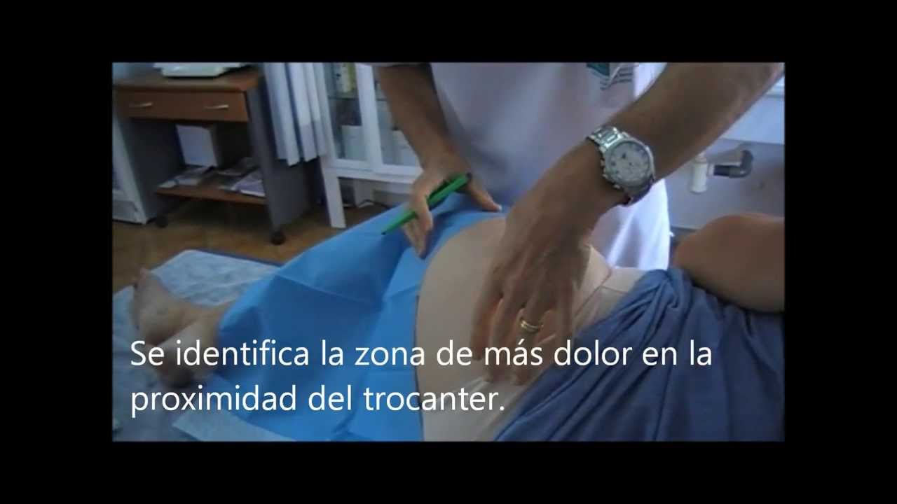 Infiltración bursitis trocantérea