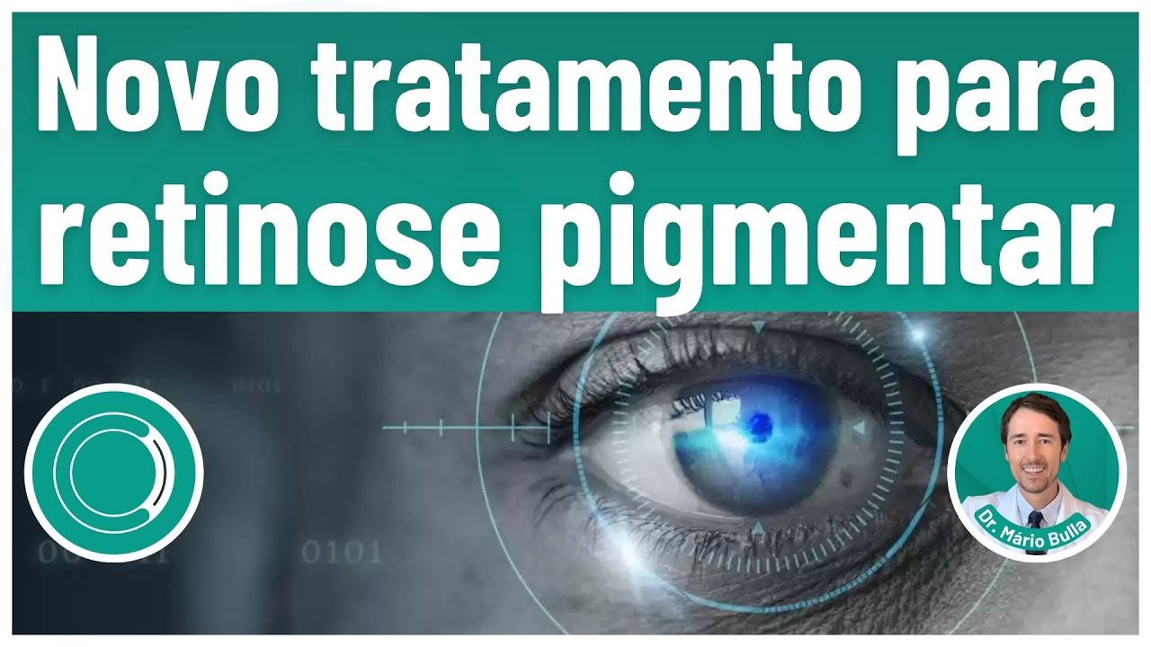 Novo tratamento para Retinose Pigmentar !!