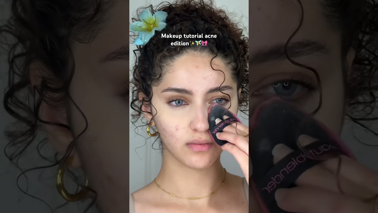 Acne makeup tutorial