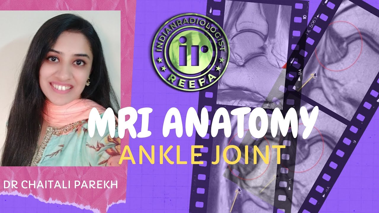 ANKLE JOINT ANATOMY ON MRI | DR CHAITALI PAREKH | ANKLE TENDONS AND LIGAMENTS | REPORTING CHECKLIST