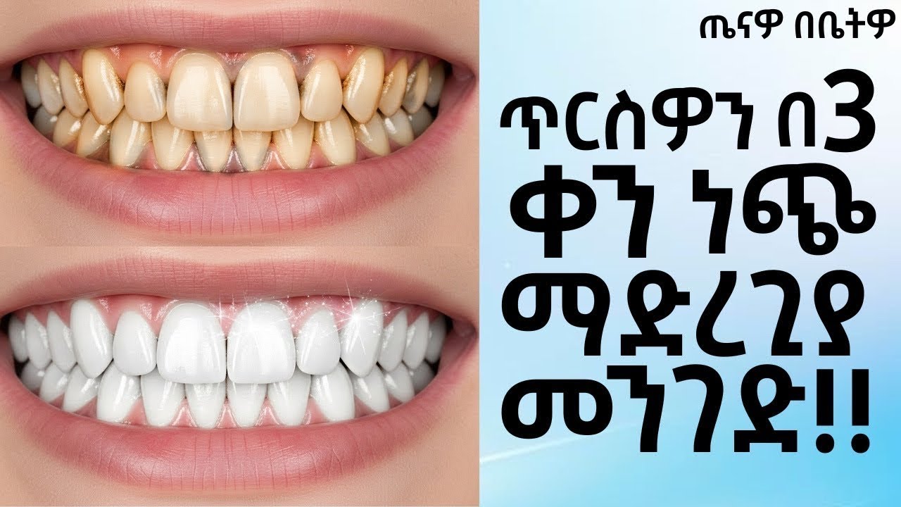 ጥርስዎን በ3 ቀን ነጭ ማድረጊያ ፍቱን መንገድ!! ( The secret way to make your teeth white in 3 days) |Tena Bebeto !