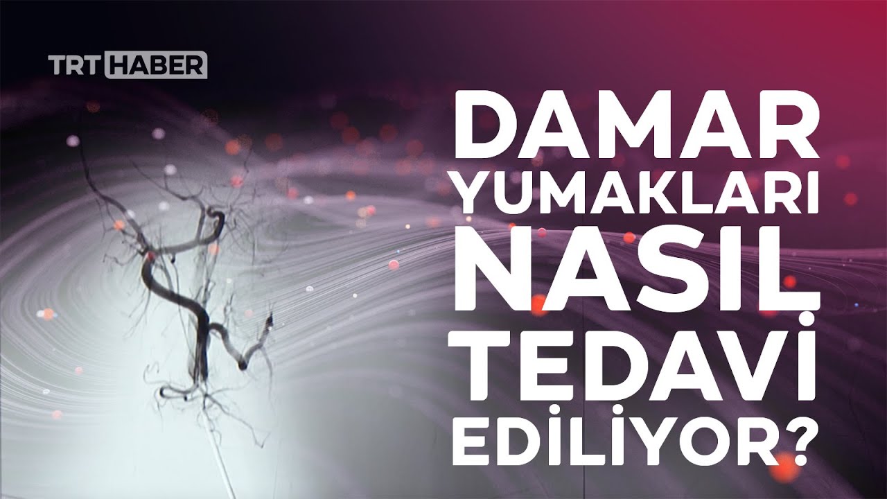 Damar yumaklarını küçültmek mümkün