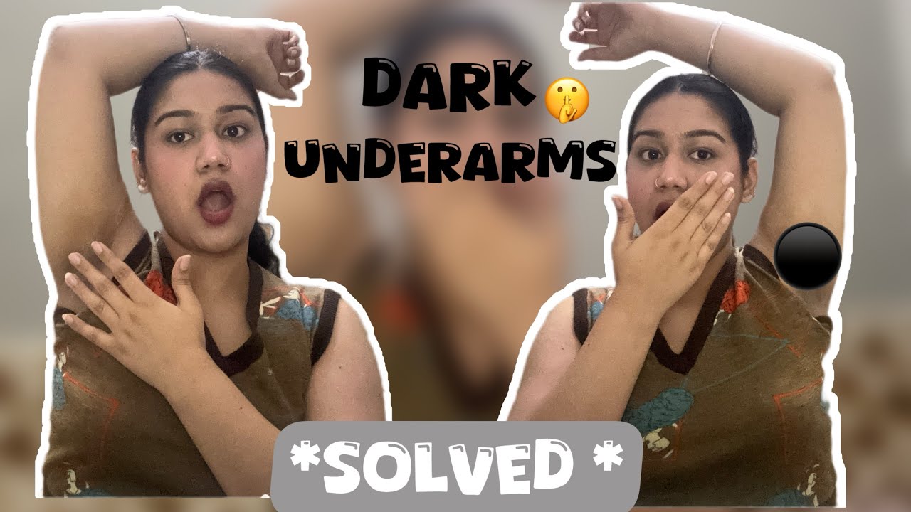 Solved* Dark underarms with just one ingredient||Ruchika kondal ||🤫