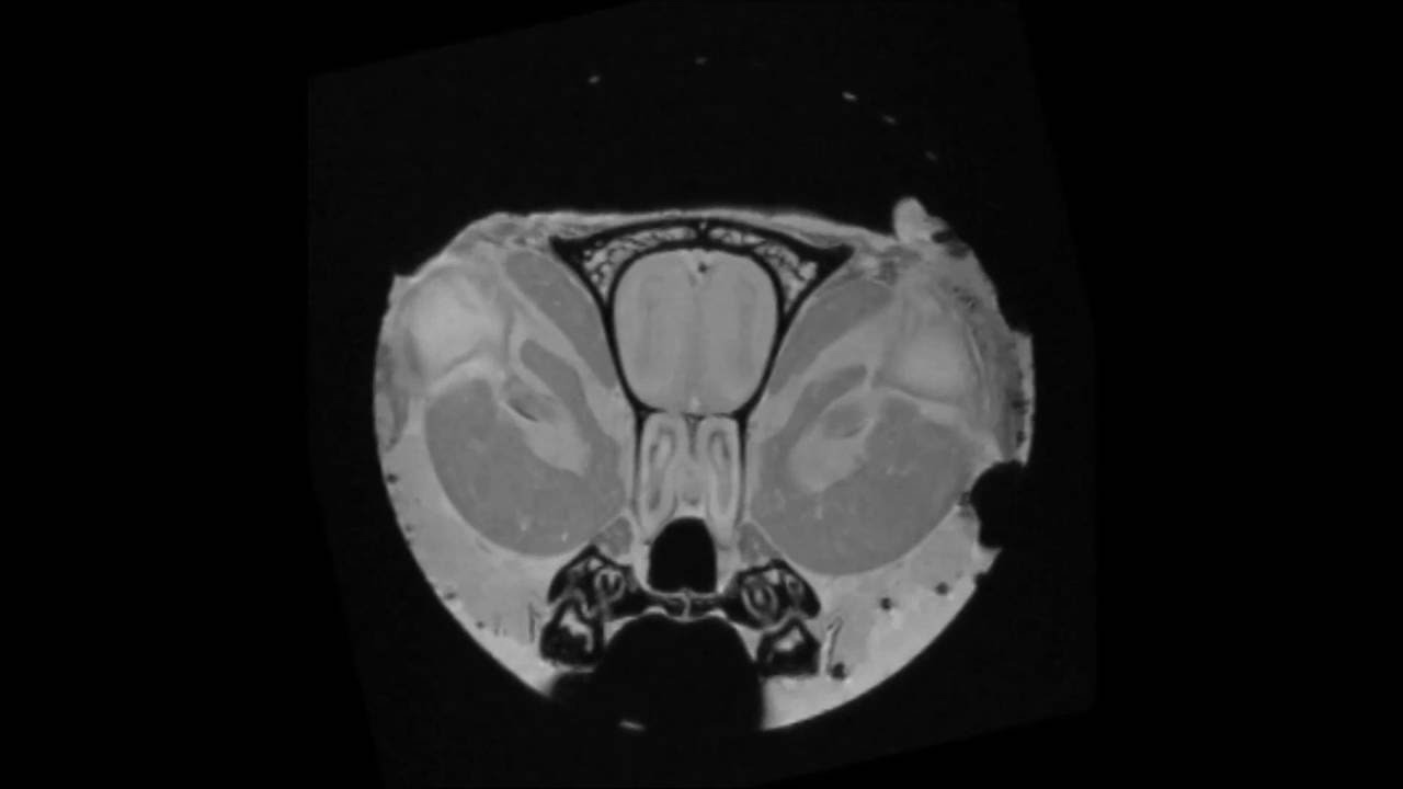 MRI Histology of the Rat Brain