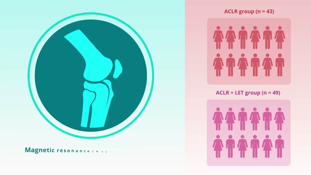 Lateral Extra-Articular Tenodesis During ACL Reconstruction