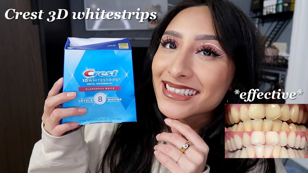 Я использовал полоски Crest 3D Whitestrips в течение 14 дней *действительно* 2023