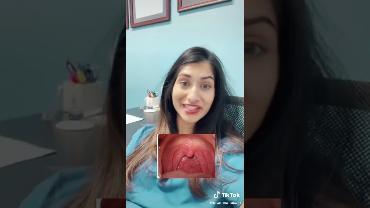 Pediatrician Breaks Down Viral Pharyngitis | Dr. Amna Husain #shorts #viralpharyngitis