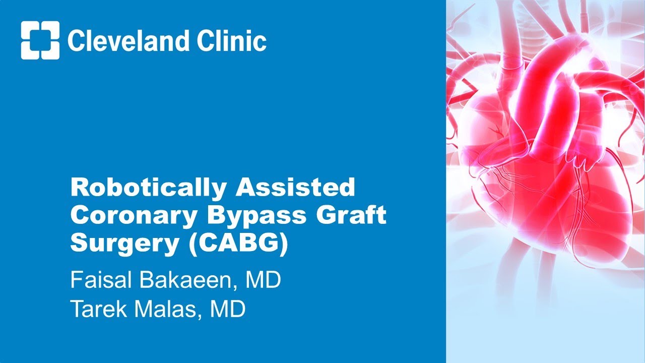 Robotically Assisted Coronary Bypass Graft Surgery (CABG)