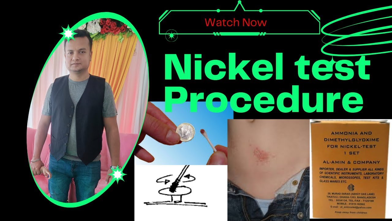 Nickel Test Procedure